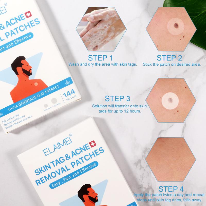 144Pcs Skin Tag Remover Patch Ance Pimple Patch Reatment Hydrocolloid Patch Protecting Skin Patch