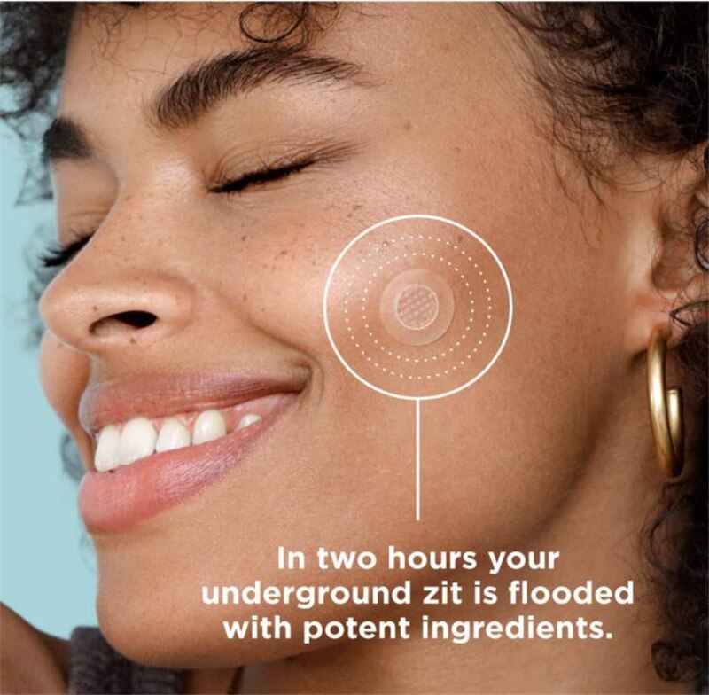 9 Patches Microneedle Acne Pimple Healing Patch Anti Acne Pimple Patch Soothing Face Skin Healing Zit Stickers Blemish Treatment