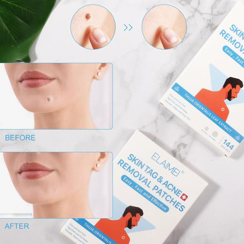 144Pcs Skin Tag Remover Patch Ance Pimple Patch Reatment Hydrocolloid Patch Protecting Skin Patch